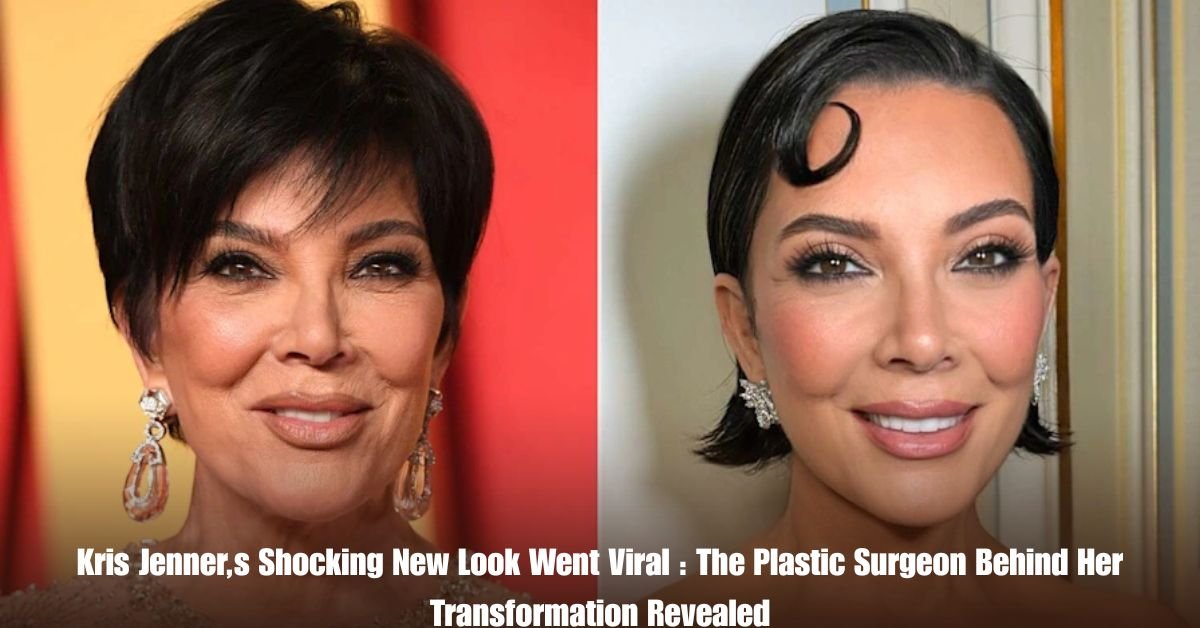 Kris Jenner,s Shocking New Look Went Viral : The Plastic Surgeon Behind Her Transformation Revealed 2 6 on Private Jet Presumed Dead After Crash Into San Diego Neighborhood 26