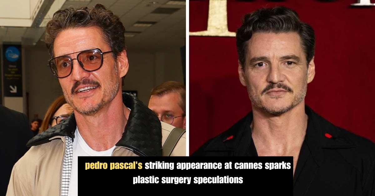 pedro pascal's striking appearance at cannes sparks plastic surgery speculations 3 Donald Trump Declares Taylor Swift No Longer Hot Igniting Renewed Feud 5