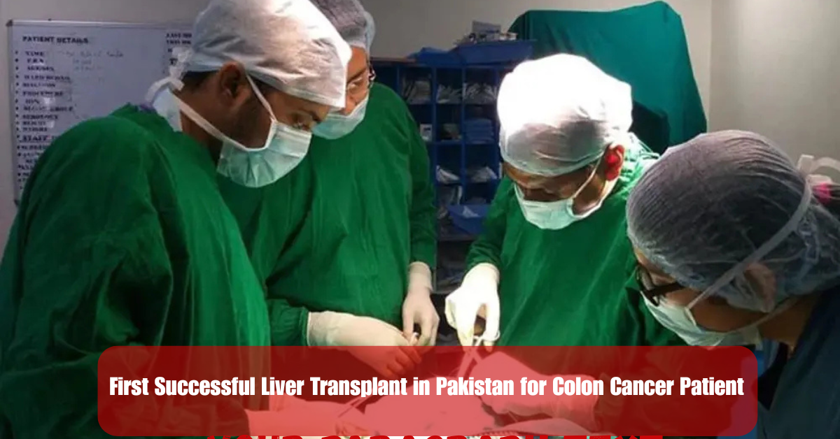 First Successful Liver Transplant in Pakistan for Colon Cancer Patient 2 Add a heading 22 1