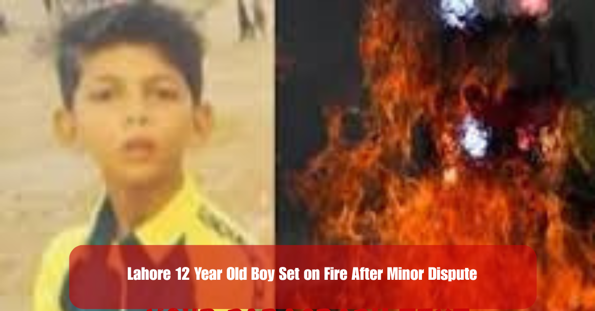 Lahore 12 Year Old Boy Set on Fire After Minor Dispute 2 Add a heading 32 1