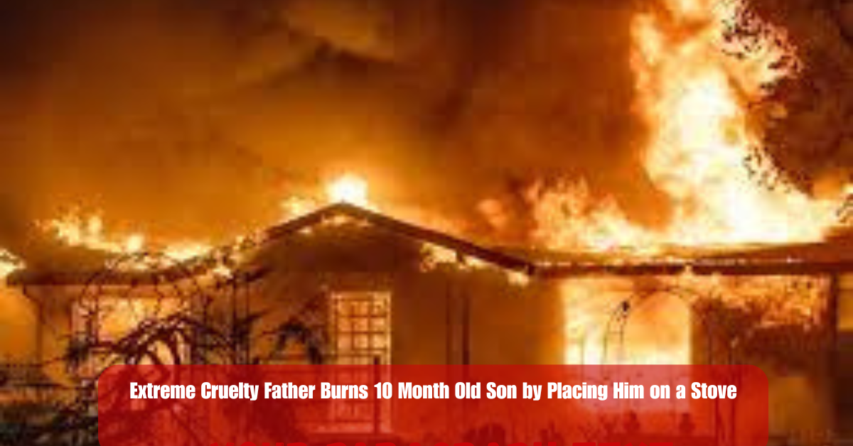 Extreme Cruelty Father Burns 10 Month Old Son by Placing Him on a Stove 2 Add a heading 43 1