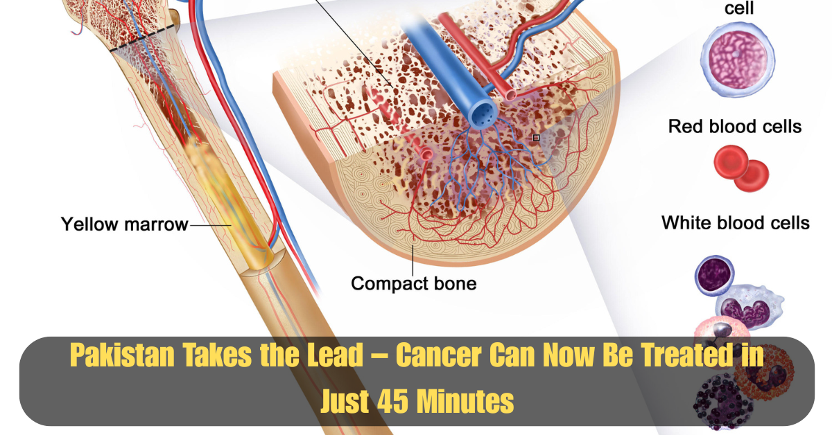 Pakistan Takes the Lead – Cancer Can Now Be Treated in Just 45 Minutes 1 Add a heading 51