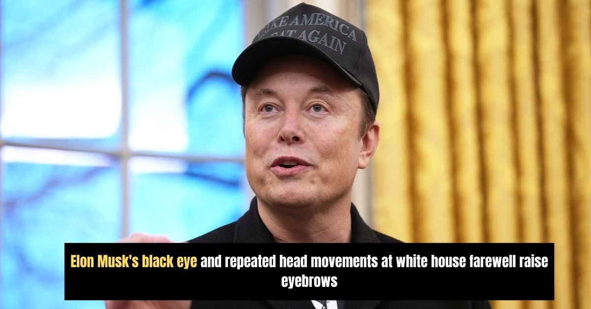 Elon Musk's black eye and repeated head movements at white house farewell raise eyebrows 2 Diddys disturbing courtroom revelations applesauce burgers and abuse allegations shock manhattan trial 32 1