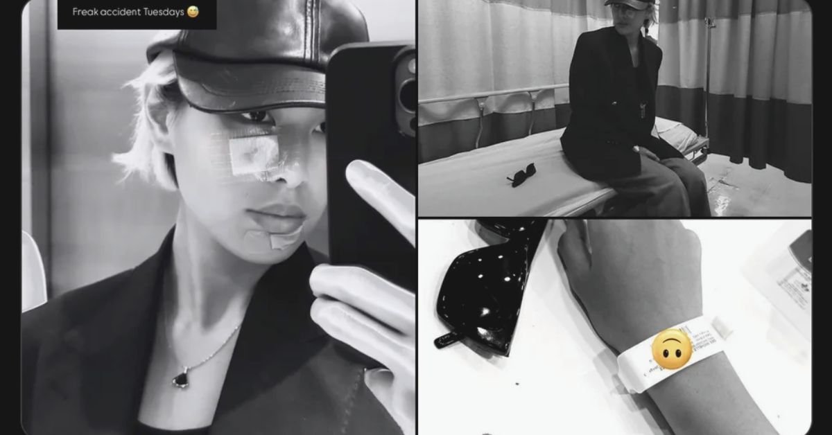 Michelle Dee Warns Fans After Dog Bite to the Face: “Never Underestimate Dog Bites!” 2 Michelle Dee Issues Health Warning After Scary Dog Bite Incident 2