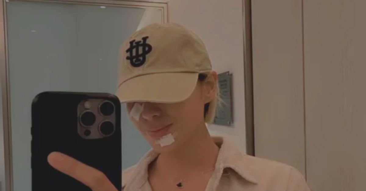 Michelle Dee Warns Fans After Dog Bite to the Face: “Never Underestimate Dog Bites!” 4 Michelle Dee Issues Health Warning After Scary Dog Bite Incident 3
