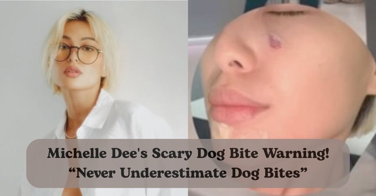 Michelle Dee shares scary pet mishap after getting bitten in the face by her dog.