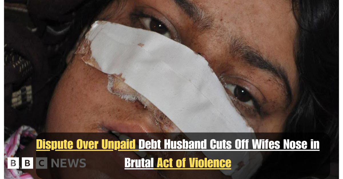 Dispute Over Unpaid Debt Husband Cuts Off Wifes Nose in Brutal Act of Violence 1 Add a heading 2025 07 13T001702.087