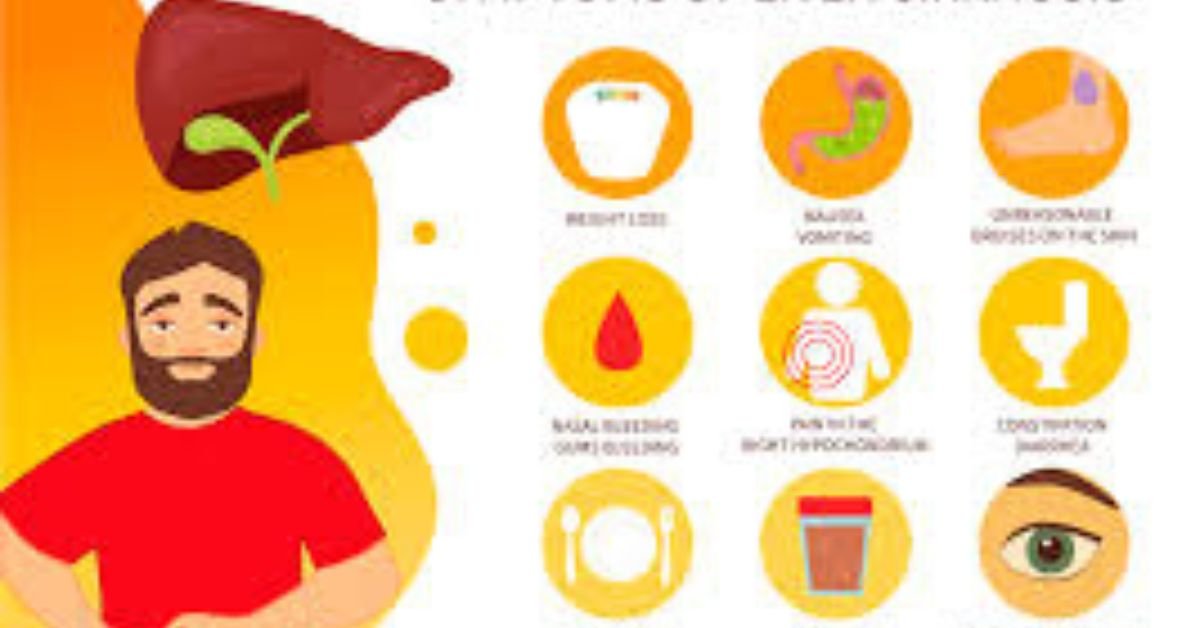 Signs of Liver Disease Early Symptoms Warning Signs and When to Seek Help 1 heloo g 30 2