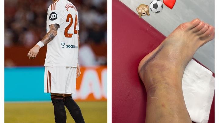 Fans React to Photo of Adnan Januzaj Foot After Barcelona 4-1 Defeat 1 63c569a66f924b449b422d67ca300215