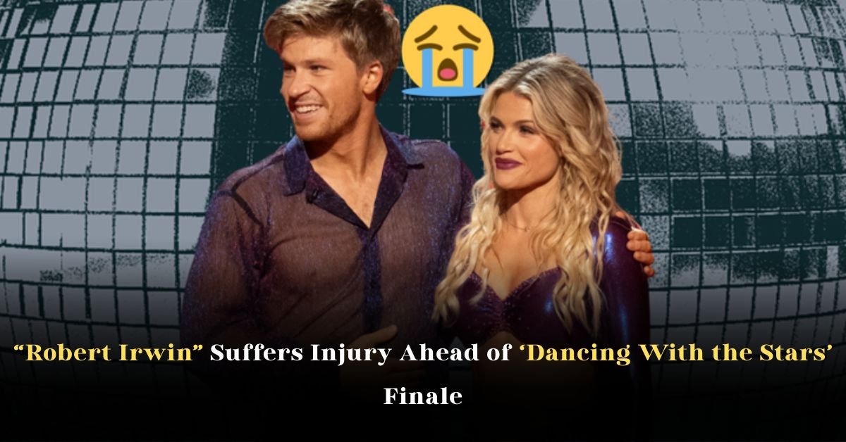 Robert Irwin Suffers Injury Ahead of ‘Dancing With the Stars’ Finale