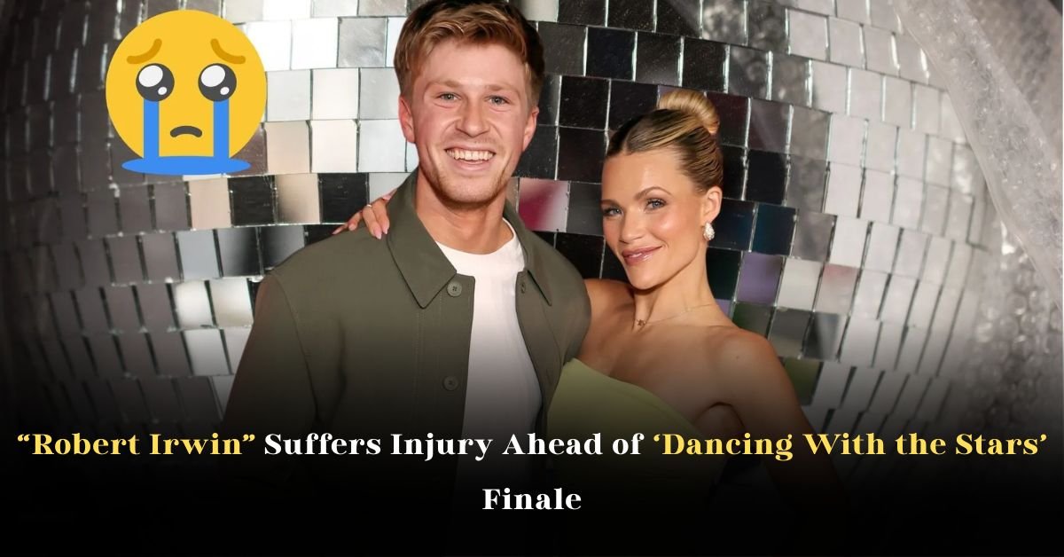 Robert Irwin Suffers Injury Ahead of ‘Dancing With the Stars’ Finale