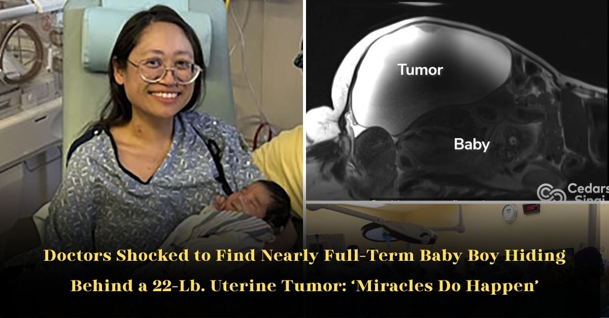 Doctors Shocked to Find Nearly Full-Term Baby Boy Hiding Behind a 22-Lb. Uterine Tumor: Miracles Do Happen