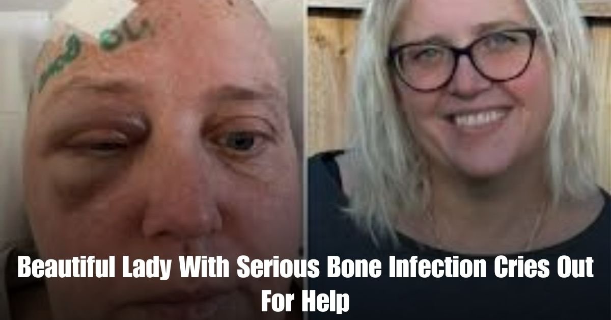 Beautiful Lady With Serious Bone Infection Cries Out For Help