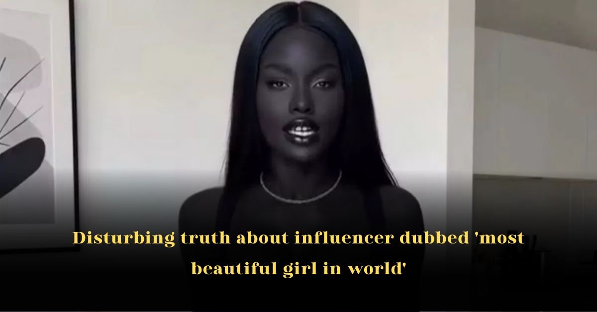 Disturbing truth about influencer dubbed 'most beautiful girl in world'